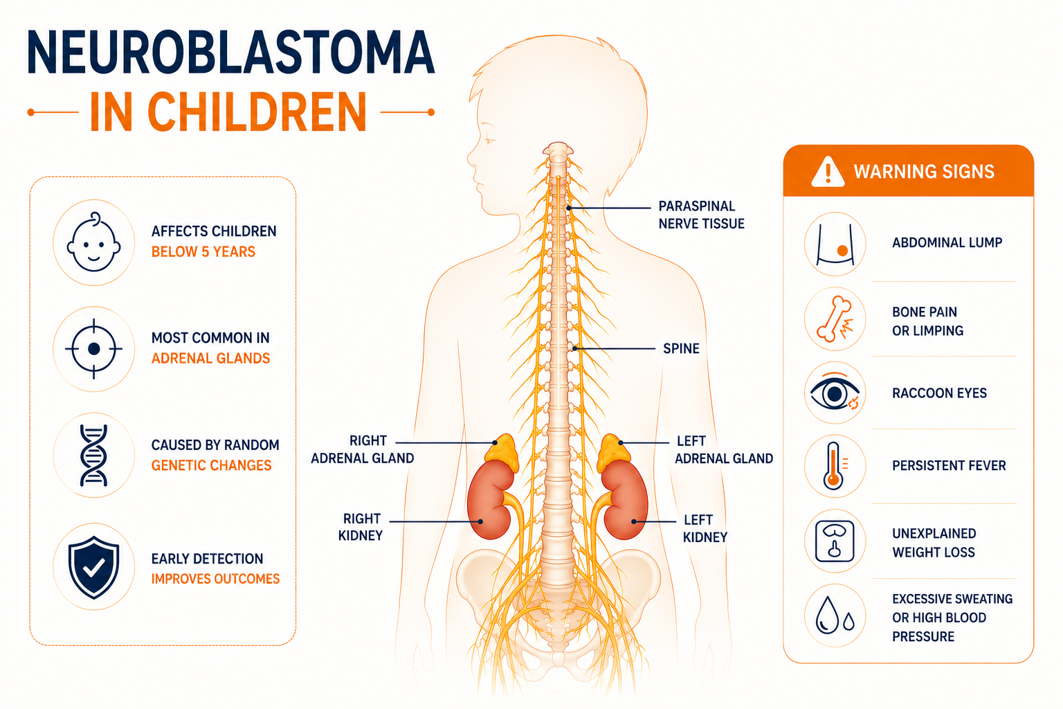 Infographic showing neuroblastoma in children, including adrenal gland tumour location, warning signs, metastatic spread, and stage 4 neuroblastoma overview