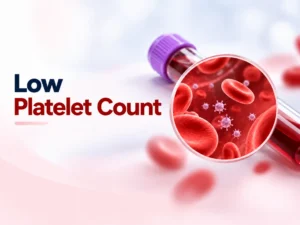 Low Platelet Count: Causes, Symptoms & What Level Is Dangerous